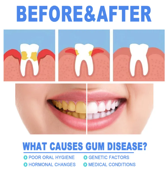 Teeth Repair & Gum Care Gel 4ml – Hyaluronic Acid, Aloe & Vitamin C, Oral Hygiene