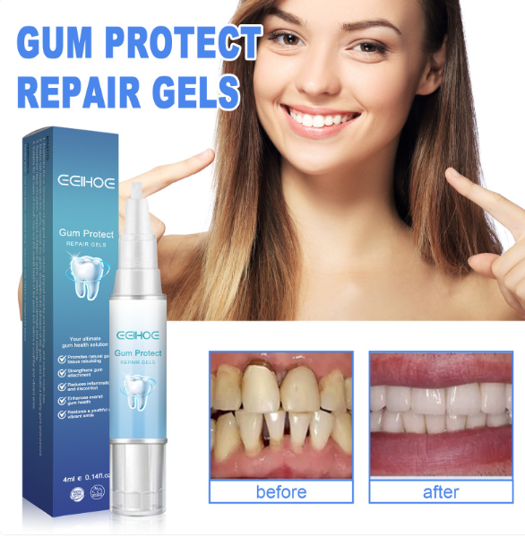 Teeth Repair & Gum Care Gel 4ml – Hyaluronic Acid, Aloe & Vitamin C, Oral Hygiene